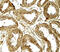 Histone Deacetylase 6 antibody, 7901, ProSci Inc, Immunohistochemistry frozen image 