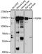 Fibroblast Growth Factor Receptor 4 antibody, STJ29693, St John