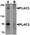 Pappalysin-2 antibody, NBP1-76487, Novus Biologicals, Western Blot image 
