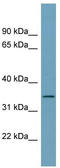 Syndecan Binding Protein antibody, TA336155, Origene, Western Blot image 