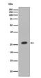Homeobox B9 antibody, M05689, Boster Biological Technology, Western Blot image 