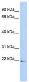 PDZ and LIM domain protein 5 antibody, TA336117, Origene, Western Blot image 