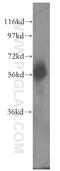 Protein artemis antibody, 11747-1-AP, Proteintech Group, Western Blot image 