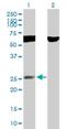 RING finger protein 141 antibody, H00050862-B02P, Novus Biologicals, Western Blot image 
