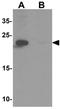 Zinc finger FYVE domain-containing protein 21 antibody, GTX32080, GeneTex, Western Blot image 