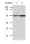 Caspase 2 antibody, TA324171, Origene, Western Blot image 
