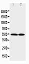 C-C Motif Chemokine Receptor 3 antibody, LS-C313284, Lifespan Biosciences, Western Blot image 