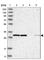Replication Protein A2 antibody, HPA026309, Atlas Antibodies, Western Blot image 