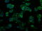 Proteasome 26S Subunit, ATPase 3 antibody, GTX83784, GeneTex, Immunofluorescence image 