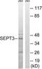 Neuronal-specific septin-3 antibody, TA312690, Origene, Western Blot image 