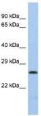 DNA polymerase lambda antibody, TA334470, Origene, Western Blot image 