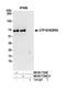 UTP18 Small Subunit Processome Component antibody, NB100-77295, Novus Biologicals, Western Blot image 