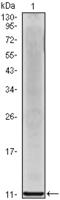Neutrophil-activating protein 1 antibody, M00423, Boster Biological Technology, Western Blot image 