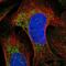 Chemokine Like Factor antibody, NBP2-56745, Novus Biologicals, Immunofluorescence image 