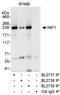 CTD small phosphatase-like protein antibody, A300-797A, Bethyl Labs, Immunoprecipitation image 