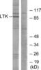 Leukocyte tyrosine kinase receptor antibody, LS-B11348, Lifespan Biosciences, Western Blot image 