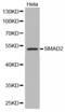 HsMAD2 antibody, LS-C330963, Lifespan Biosciences, Western Blot image 