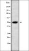 Disintegrin and metalloproteinase domain-containing protein 8 antibody, orb336338, Biorbyt, Western Blot image 