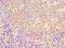 Lymphokine-activated killer T-cell-originated protein kinase antibody, orb352829, Biorbyt, Immunohistochemistry paraffin image 