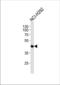 Absent In Melanoma 2 antibody, TA328184, Origene, Western Blot image 