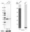 ELOVL Fatty Acid Elongase 5 antibody, HPA047752, Atlas Antibodies, Western Blot image 