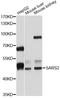 Seryl-tRNA synthetase, mitochondrial antibody, LS-C747428, Lifespan Biosciences, Western Blot image 