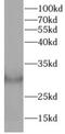 Collagen Type X Alpha 1 Chain antibody, FNab10026, FineTest, Western Blot image 
