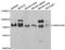 Ubiquitin Associated And SH3 Domain Containing B antibody, A7141, ABclonal Technology, Western Blot image 