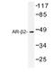 ADRB2 antibody, AP01192PU-N, Origene, Western Blot image 