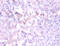 NADH:Ubiquinone Oxidoreductase Subunit A1 antibody, A51437-100, Epigentek, Immunohistochemistry paraffin image 
