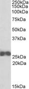 Rho GDP Dissociation Inhibitor Beta antibody, STJ72315, St John