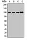 Coatomer Protein Complex Subunit Gamma 1 antibody, LS-C668659, Lifespan Biosciences, Western Blot image 