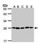Proteasome Subunit Alpha 2 antibody, LS-C185550, Lifespan Biosciences, Western Blot image 