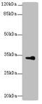 Dehydrogenase/Reductase 3 antibody, A62410-100, Epigentek, Western Blot image 