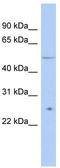 Tetratricopeptide Repeat Domain 8 antibody, TA331018, Origene, Western Blot image 