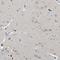 Serine Protease 12 antibody, HPA035054, Atlas Antibodies, Immunohistochemistry frozen image 