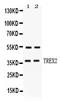 Three prime repair exonuclease 2 antibody, PB10105, Boster Biological Technology, Western Blot image 