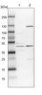 Spindlin Interactor And Repressor Of Chromatin Binding antibody, PA5-59077, Invitrogen Antibodies, Western Blot image 