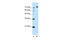 Corin, Serine Peptidase antibody, 30-225, ProSci, Western Blot image 