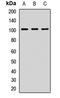 DLG1 antibody, LS-C668494, Lifespan Biosciences, Western Blot image 