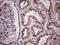 Clathrin Light Chain A antibody, LS-C792165, Lifespan Biosciences, Immunohistochemistry paraffin image 