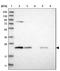 Proteasome Subunit Beta 6 antibody, NBP1-88024, Novus Biologicals, Western Blot image 