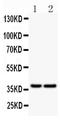 CD79a antibody, PB9168, Boster Biological Technology, Western Blot image 