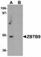 Zinc Finger And BTB Domain Containing 9 antibody, orb75554, Biorbyt, Western Blot image 