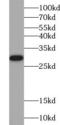 Galectin 3 antibody, FNab03317, FineTest, Western Blot image 