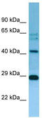 Mitochondrial Ribosomal Protein L38 antibody, TA343223, Origene, Western Blot image 