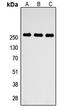 ATP Binding Cassette Subfamily A Member 4 antibody, LS-C354507, Lifespan Biosciences, Western Blot image 