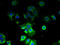 Cap Methyltransferase 2 antibody, A58606-100, Epigentek, Immunofluorescence image 
