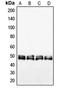 Vasodilator Stimulated Phosphoprotein antibody, LS-C352983, Lifespan Biosciences, Western Blot image 