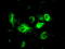 GFAP antibody, LS-C784181, Lifespan Biosciences, Immunofluorescence image 